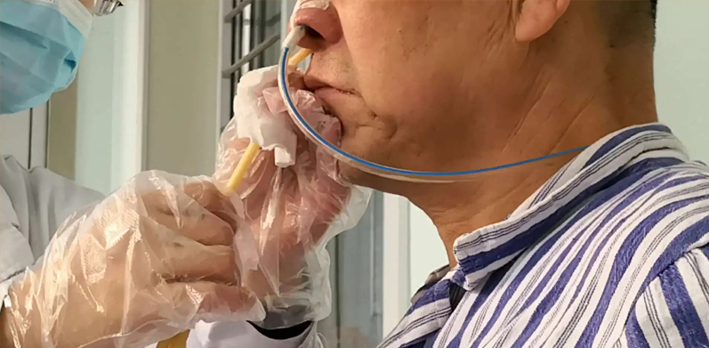 科學(xué)吞咽訓(xùn)練，重享美食風(fēng)味